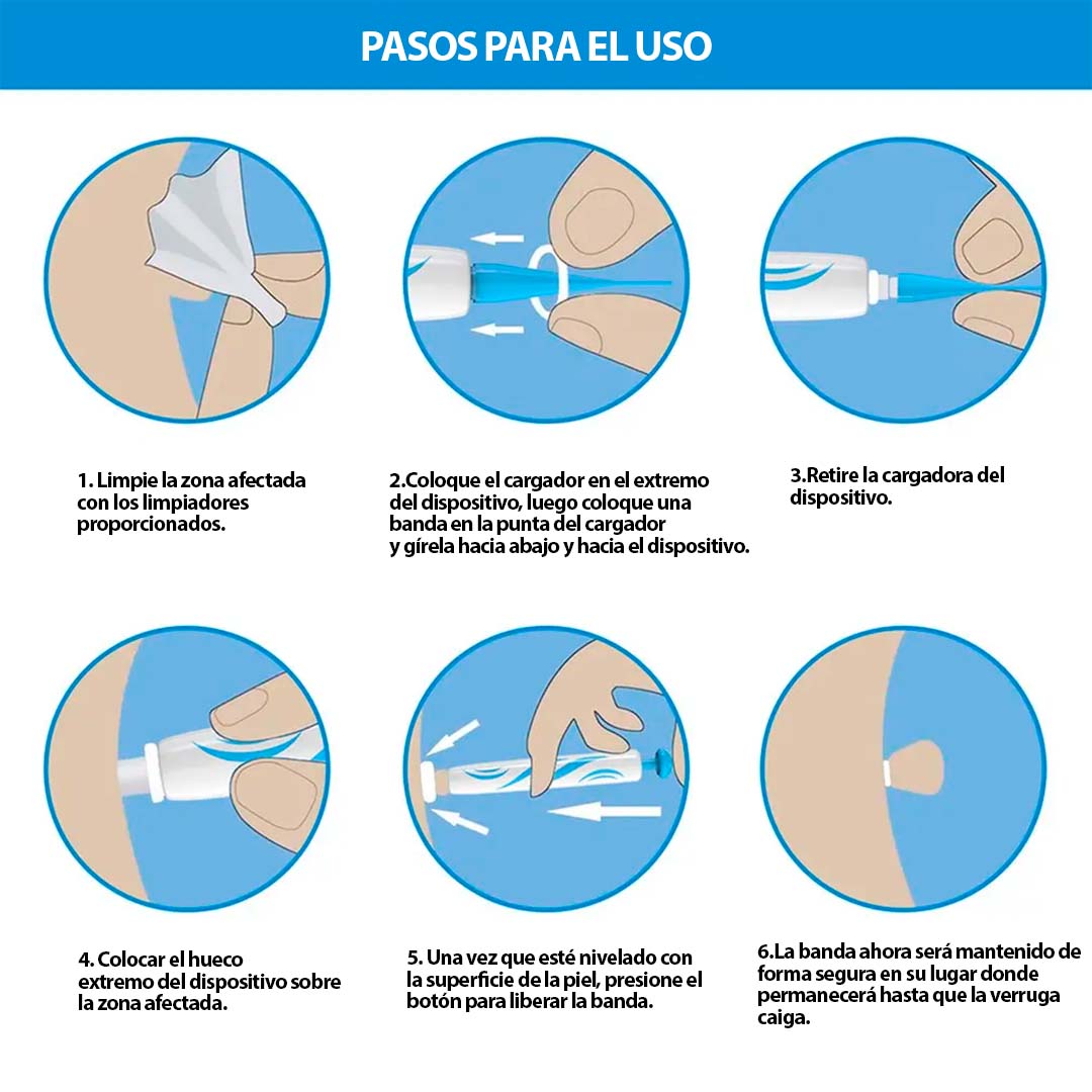 Kit Eliminador De Verrugas