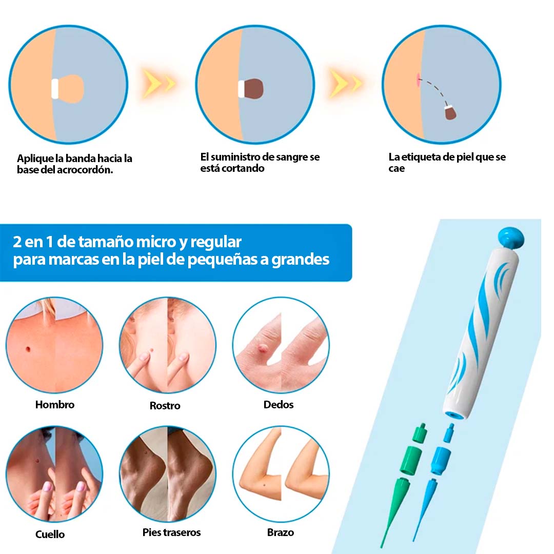 Kit Eliminador De Verrugas