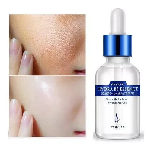 Acido Hialuronico B5