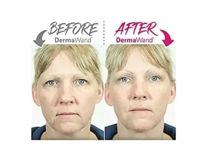 Lifting y Tonificador Facial