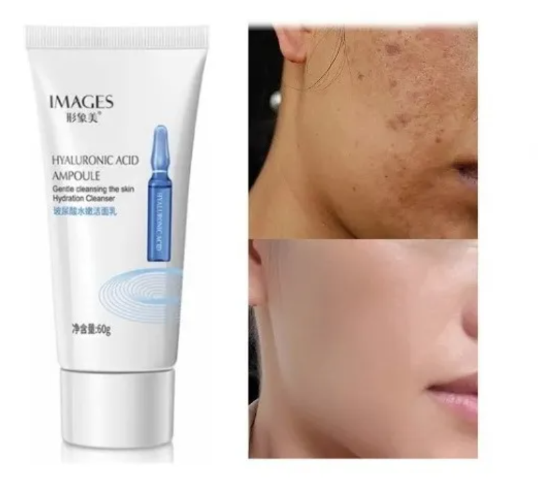 Espuma Facial con Ácido Hialurónico.